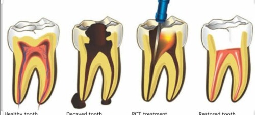 Mittal Dental Clinic takes pride in being one of the best dental implant doctors in Jaipur, India offering state-of-the-art professional dental care.

Read More; https://mittaldentalclinic.com/dental-implant/