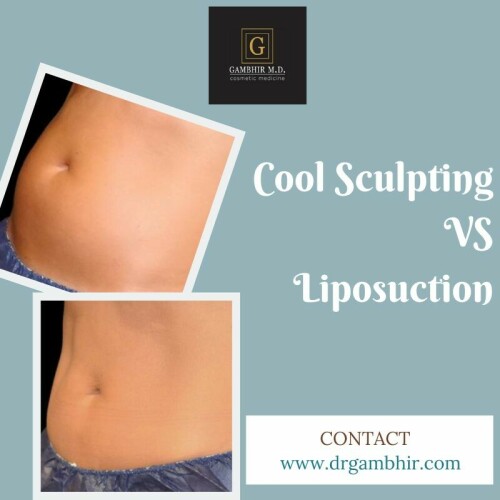 CoolSculpting is an FDA-approved procedure that gently freezes away unwanted fat cells in a natural and controlled way. Some individuals may have stubborn pockets of fat that are more difficult to reduce despite diet and exercise.

Visit: https://www.drgambhir.com