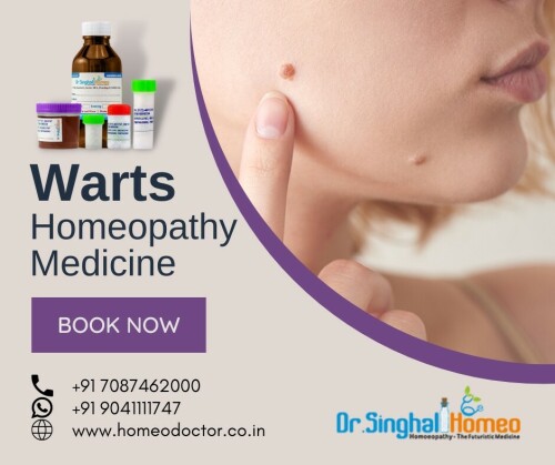 If you are suffering from warts problems and looking for a complete and effective treatment, opt for homeopathic treatment. Homeopathic Treatment for Warts uses highly personalized medicines to treat the problem. It is desirable for better management of the condition while avoiding the side effects of conventional medication. Dr. Vikas Singhal has been providing effective warts Homeopathy medicine for the past 20 years. You can call at +91 7087462000 or WhatsApp at +91 9041111747 to make an appointment. For more details, visit our website here: https://homeodoctor.co.in/best-homeopathic-medicine-and-treatment-for-warts-in-india/