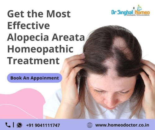 Alopecia areata Homeopathic treatment can help eliminate the problem and regain the lost hair. So if you are looking for the Best Homeopathic Medicine for Alopecia Areata in India, your quest ends here! Dr. Vikas Singhal provides the best Homeopathic treatment for various diseases at reasonable prices. He has been practicing in his clinic at Dr. Singhal Homeo, Chandigarh, for 20 years. He is one of the best Homeopathic doctors to treat various acute, chronic, rare, and autoimmune diseases across India and abroad. Moreover, his team keeps follow-ups of every case and tracks the progress of the treatments provided. For more information, call us at +91 7087462000 or WhatsApp at +91 9041111747. Visit us:https://homeodoctor.co.in/homeopathic-treatment-and-medicine-for-alopecia-areata/