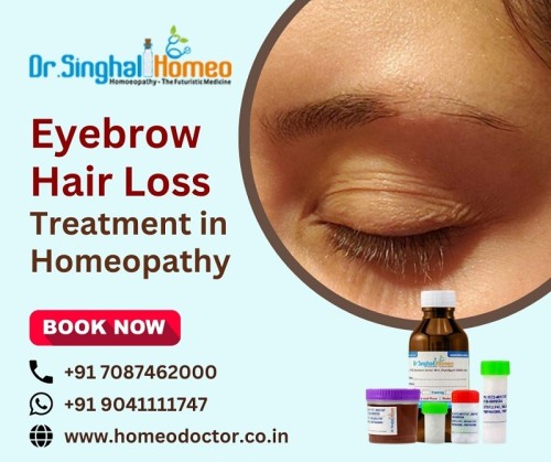 If you are looking for the best Homeopathic Eyebrow Hair Loss Treatment in India, Dr. Singhal Homeo can be the best place to go. At Dr. Singhal Homeo, Dr. Vikas Singhal provides effective  Homeopathic treatment of Eyebrow Hair Loss and various other diseases. He has 20 years of experience treating various chronic, autoimmune, and rare diseases. You can visit his clinic at Dr. Singhal Homeo in Chandigarh to get an in-person or online consultation. Reach Dr. Singhal Homeo on the following numbers: +91 7087462000 (Call), +91 9041111747 (WhatsApp). Visit us here: https://homeodoctor.co.in/best-homeopathic-medicine-and-treatment-for-eyebrow-hair-loss-in-india/