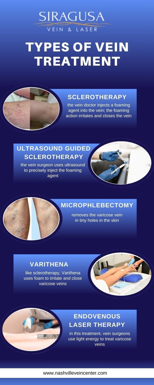 Vein treatments encompass a range of options tailored to address various venous conditions. Sclerotherapy involves injecting a solution into affected veins to prompt them to shrink and fade, primarily used for spider veins and smaller varicose veins. Visit for more -https://nashvilleveincenter.com/