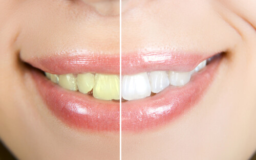 a477dd462e70853691cafd9db430b39a.jpg