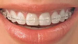 b320e93adc852cda66b4ec0c5a0983d3.jpg