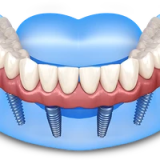 4a3f50f7ec20bac134d1be36a8a4b77e