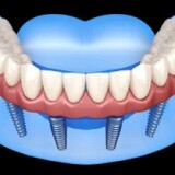 533cc8b55db9ec5f83d44982d3544b49