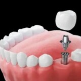 7087e7dc1a7b45c786cdb843ac6eaa4d