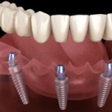 b23b15455effb09c03ff20d10eaf4ced