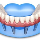 014856caa03ec2f69df3f45fb81ba0bd