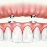 1aefd5cee551e4e405fc94c735fb21e5