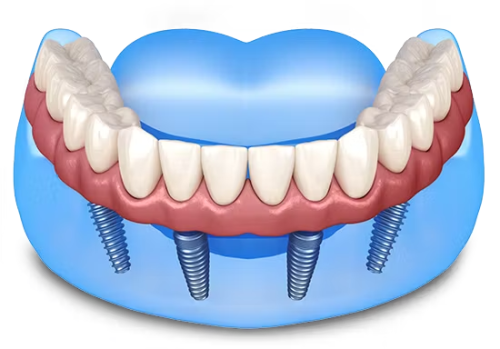 9744382cf1fca48971a45d10c20bd74f.png